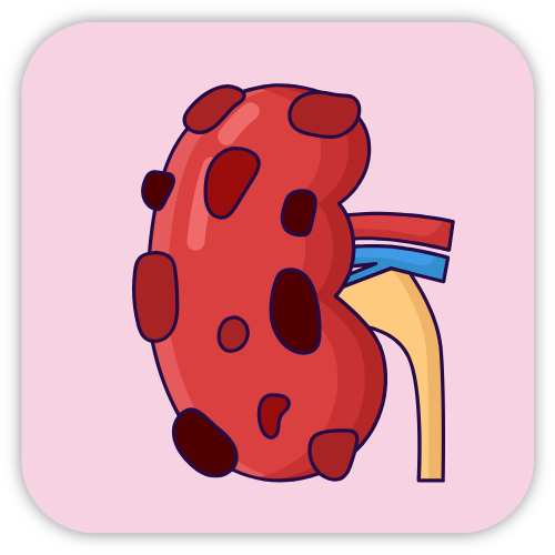 Acute Kidney Injury