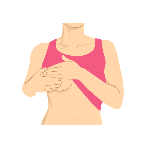 Breast Cancer