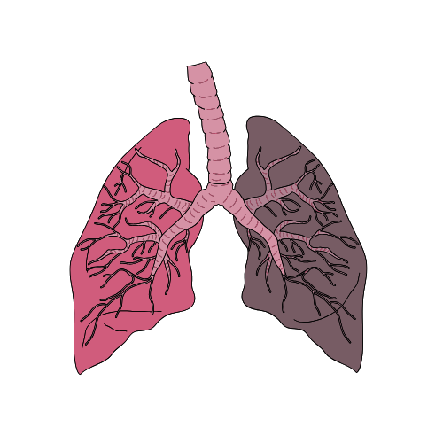 Lung Cancer